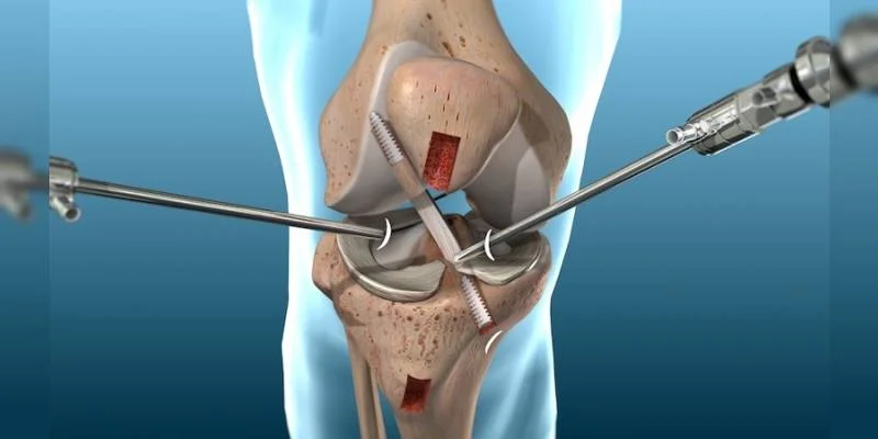 Best Arthroscopy Surgeon in Ahmedabad Best Arthroscopy Surgeon in Ahmedabad