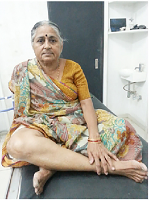 Knee replacement case 12