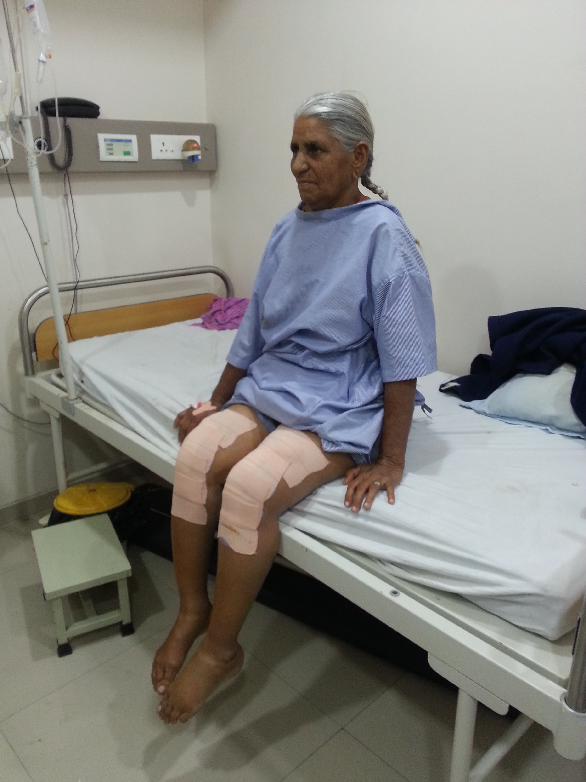 Knee replacement case 19