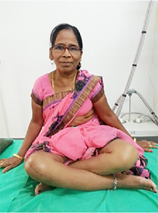 Knee replacement case 43