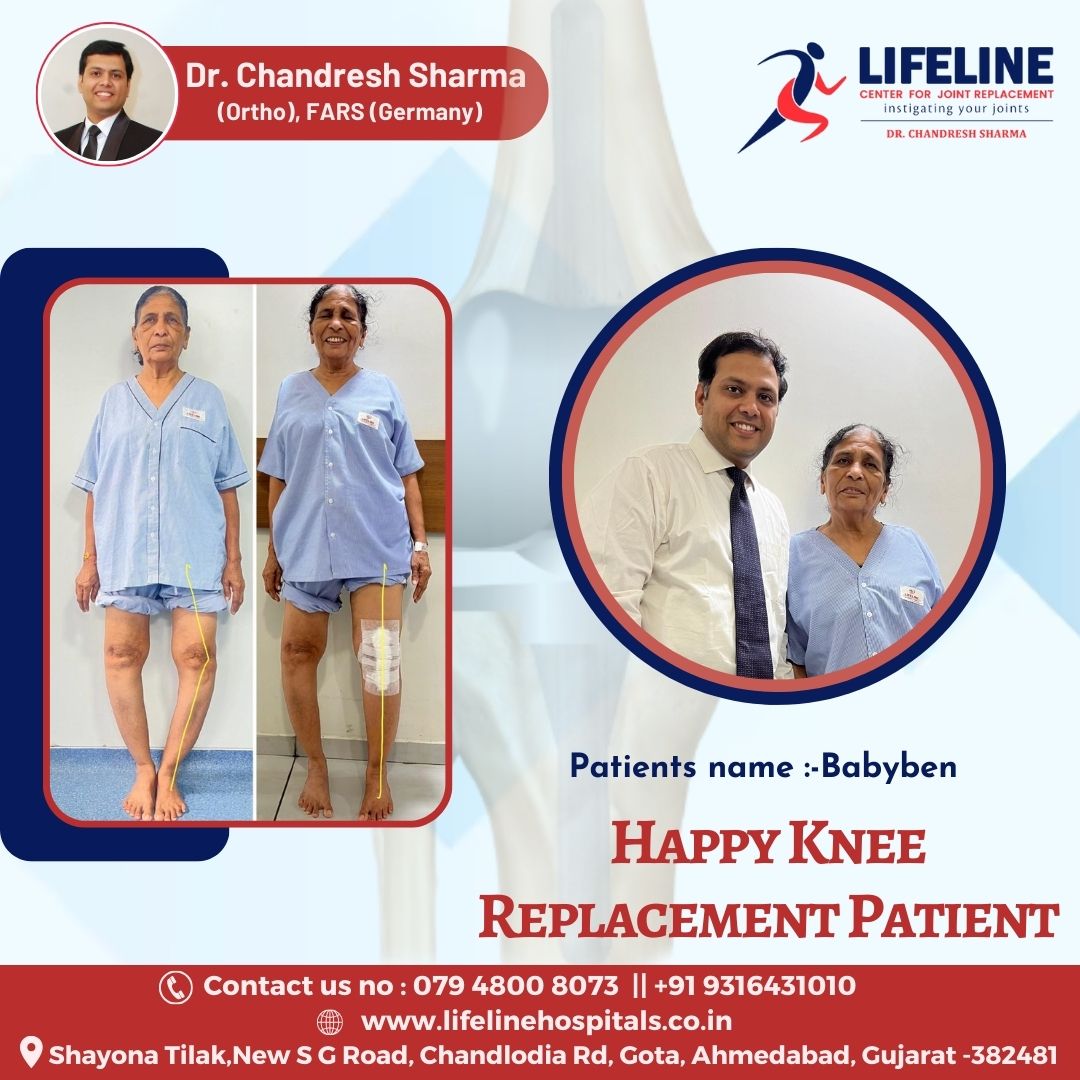 Patient treated by Dr. Chandresh Sharma, photo 11