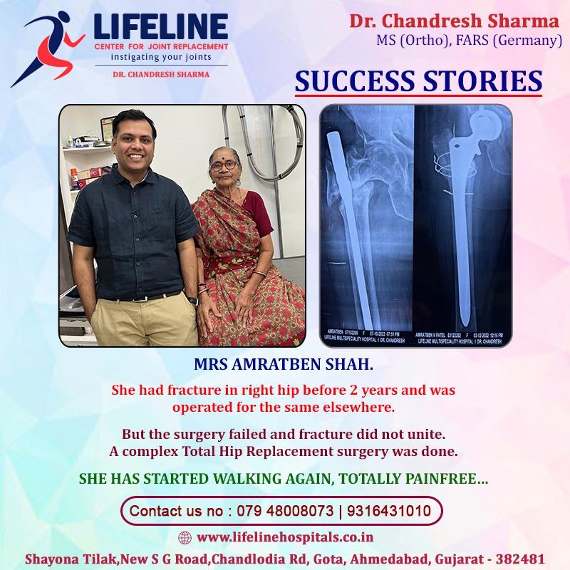 Patient treated by Dr. Chandresh Sharma, photo 36