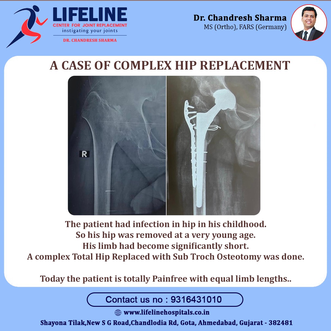 Patient treated by Dr. Chandresh Sharma, photo 51