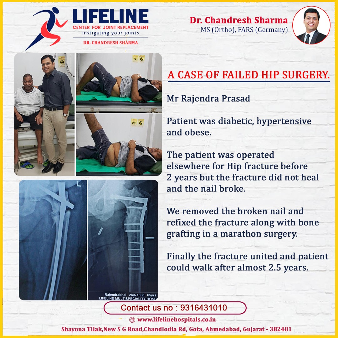 Patient treated by Dr. Chandresh Sharma, photo 52