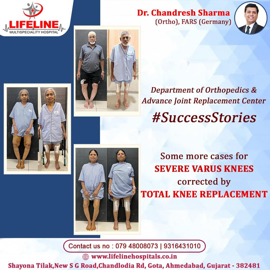 Patient treated by Dr. Chandresh Sharma, photo 65