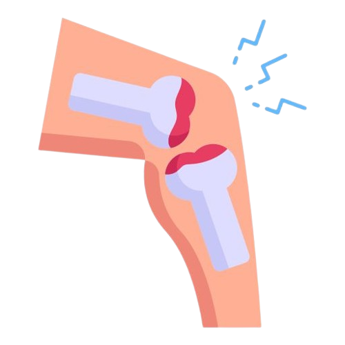 Arthroscopy